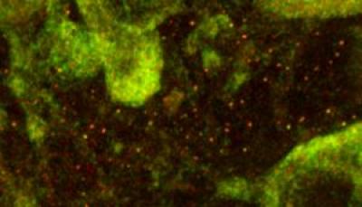 fragile x granule